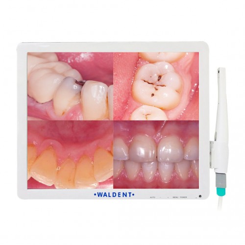Waldent Intraoral Camera Smart -Cam with PMS